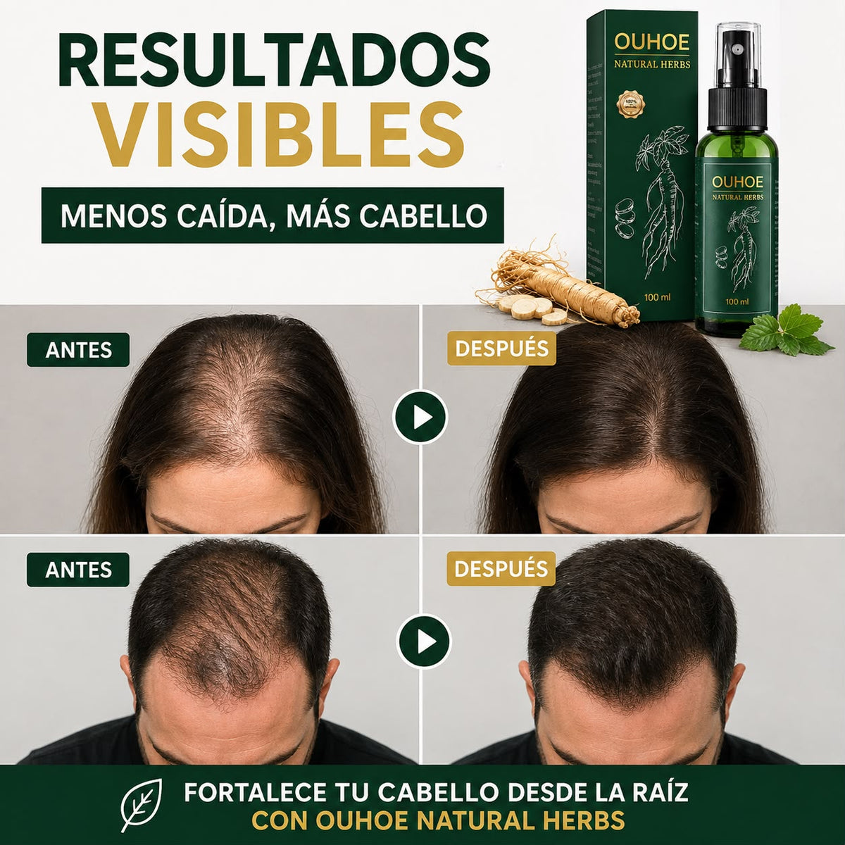 Esencia de Raiz Reduce La Caida en 7 Dias