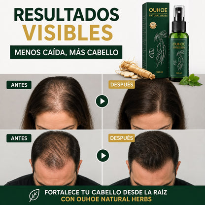 Esencia de Raiz Reduce La Caida en 7 Dias