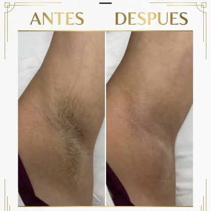 DepiLaser Pro + Regalo🎁