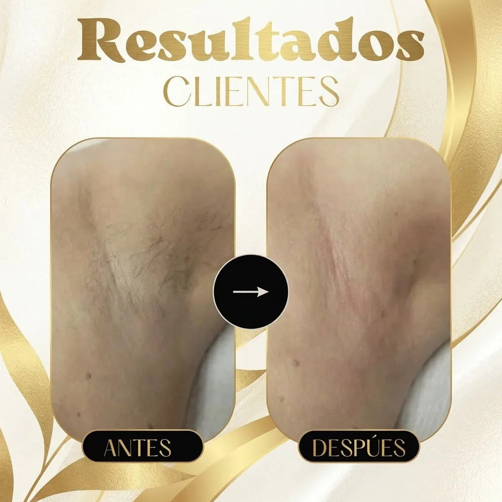 DepiLaser Pro + Regalo🎁