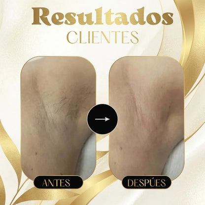 DepiLaser Pro + Regalo🎁